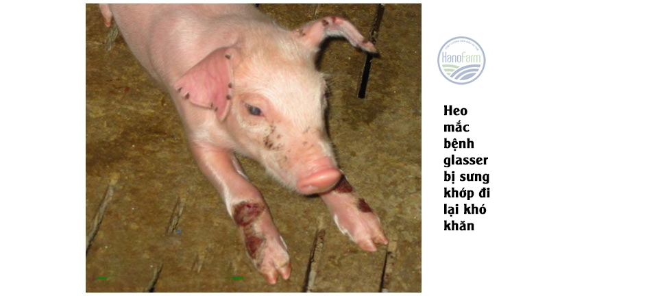 benh-glasser-o-lon-bieu-hien